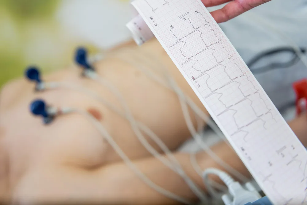Electrocardiograma (ECG)